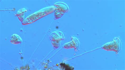  Vorticella! Un magnifique cilié en spirale qui filtre l'eau avec élégance.